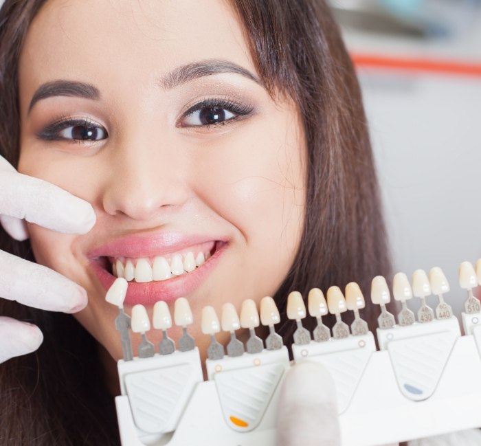 Woman's smile compared with veneers color chart