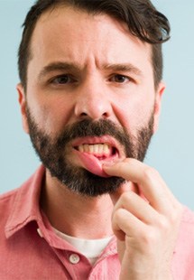 man pointing to inflamed gums