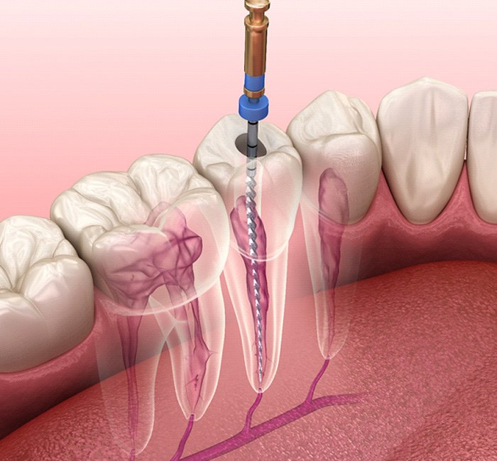 Inside of a tooth