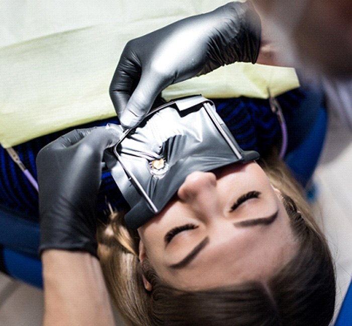 Patient undergoing root canal